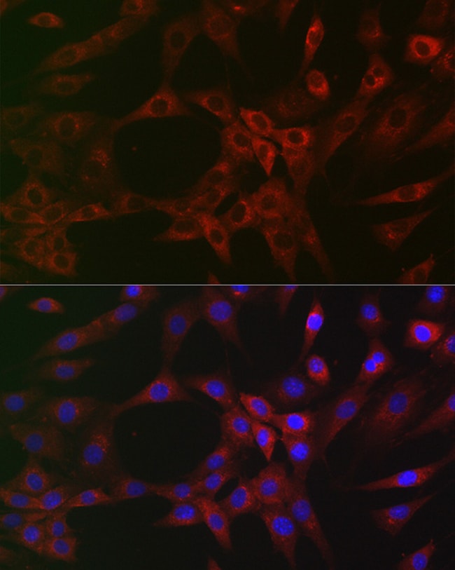 100UL ARPC2 ANTIBODY 100 UL