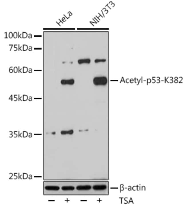 100UL ACETYL-P53 (LYS382) ANTIBODY 100 U
