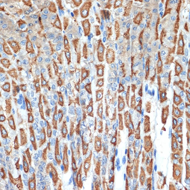 100UL ATP4B ANTIBODY 100 UL