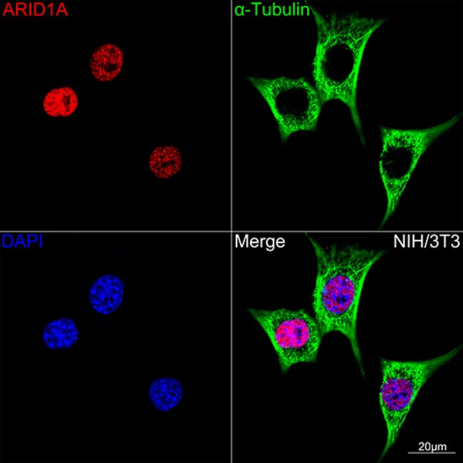 100UL ARID1A ANTIBODY 100 UL