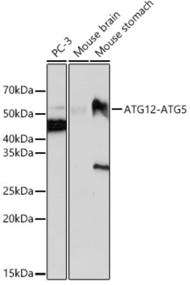 100UL ATG12 ANTIBODY 100 UL