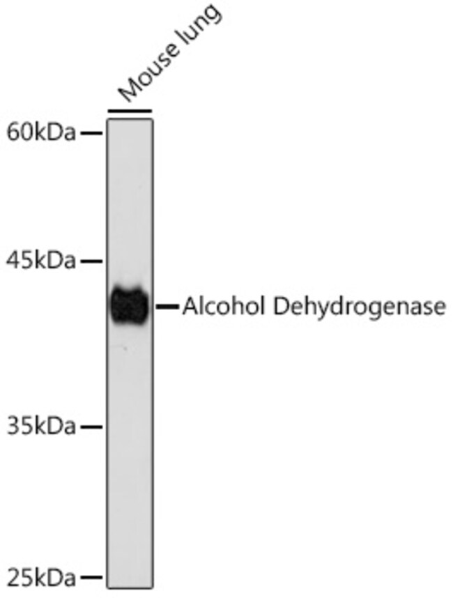 100UL ADH1A ANTIBODY 100 UL