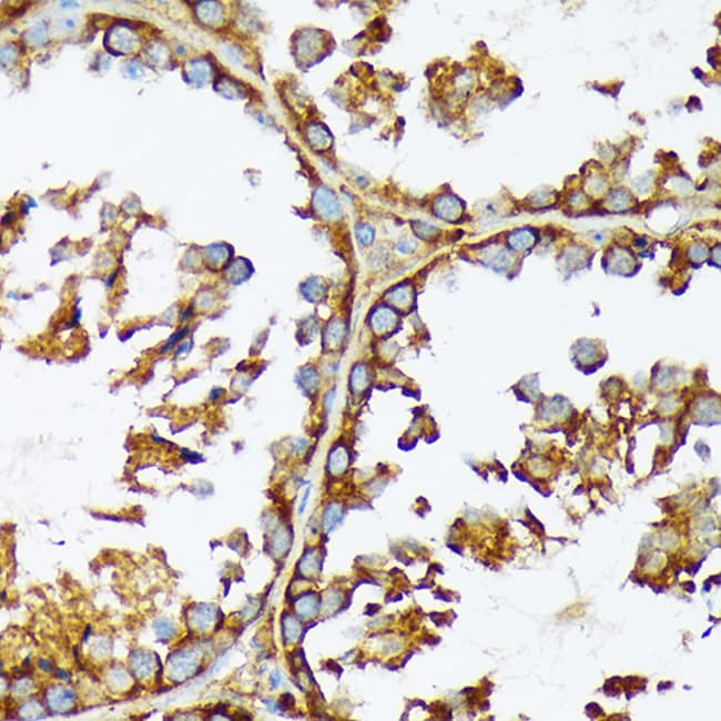 100UL ACETYL-COA CARBOXYLASE ANTIBOD 100