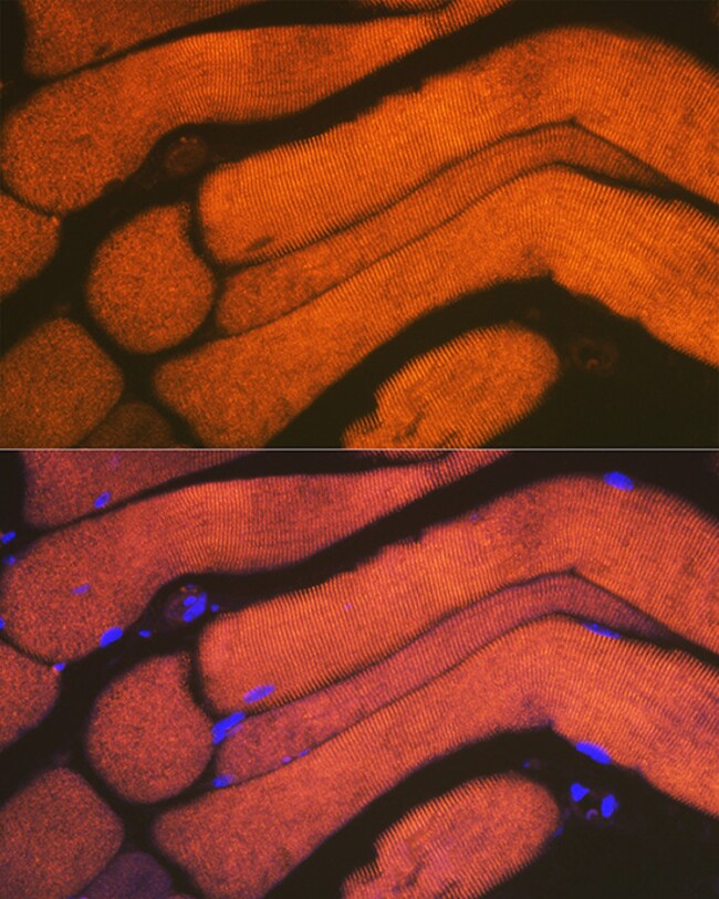 100UL ALPHA ACTININ 3 ANTIBODY 100 UL