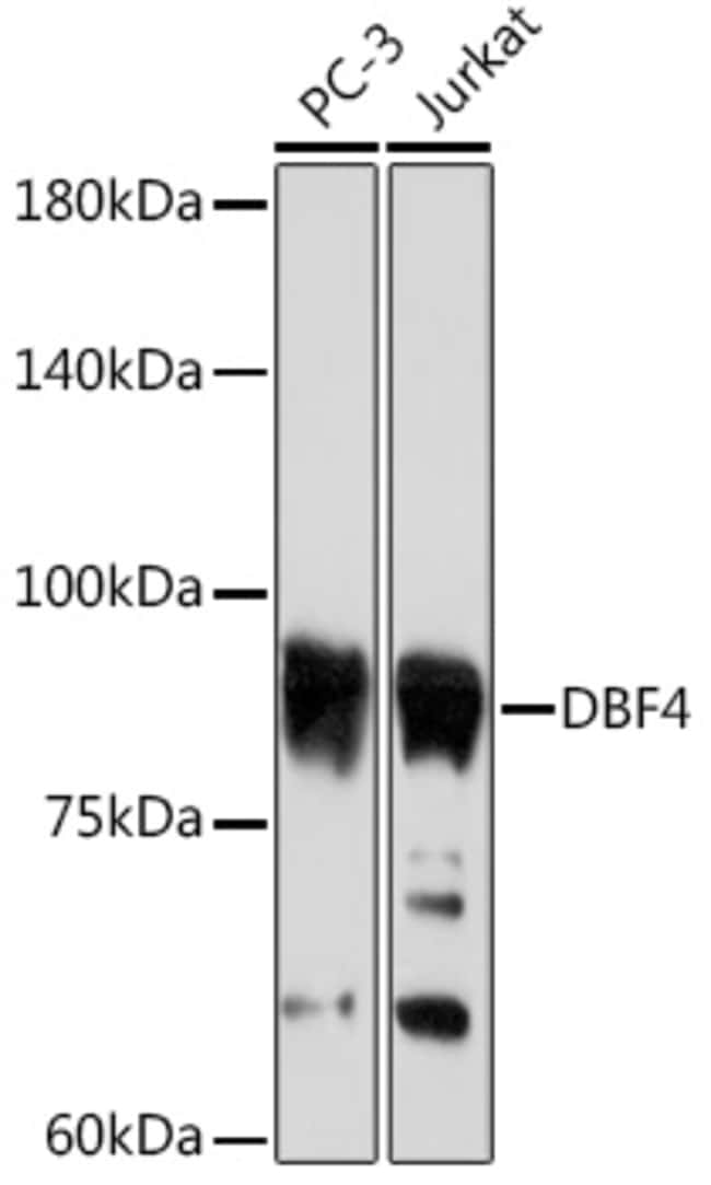 100UL ASK ANTIBODY 100 UL