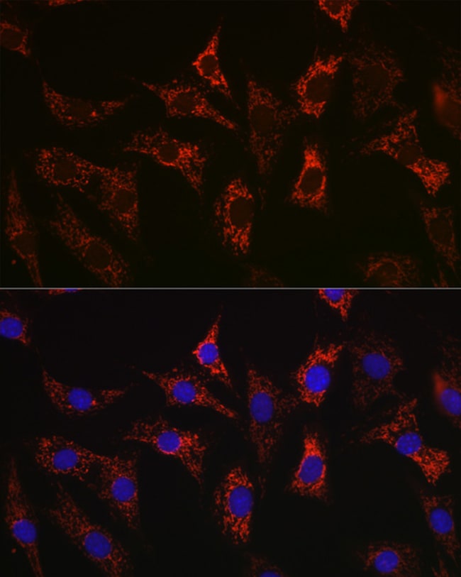 100UL BAX ANTIBODY 100 UL