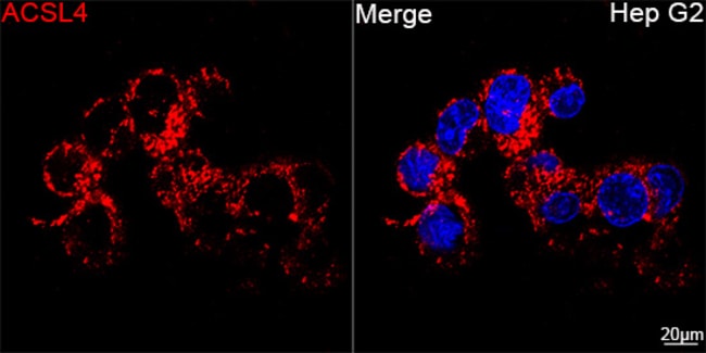100UL ACSL4 ANTIBODY 100 UL