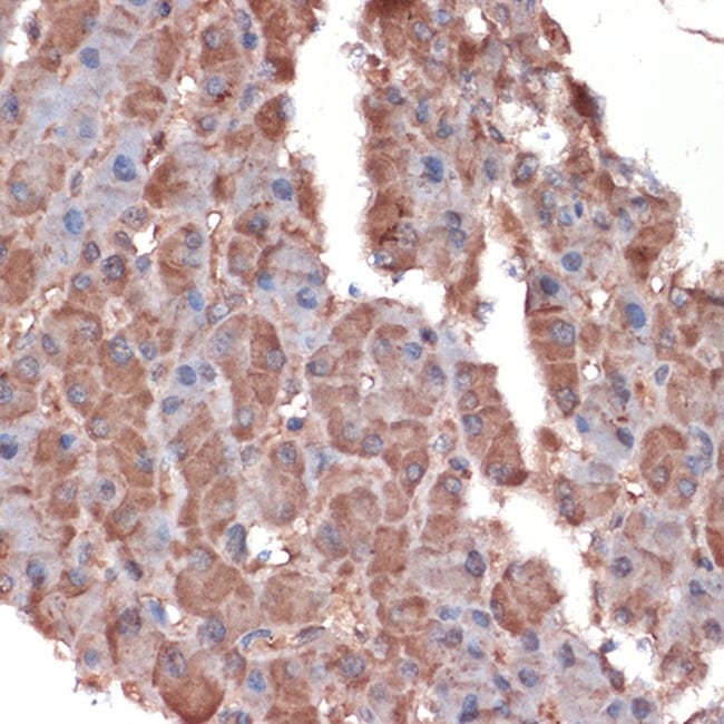 100UL APOC3 ANTIBODY 100 UL