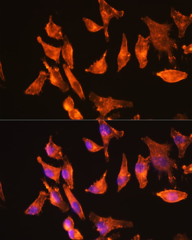 100UL ACTA1 ANTIBODY 100 UL