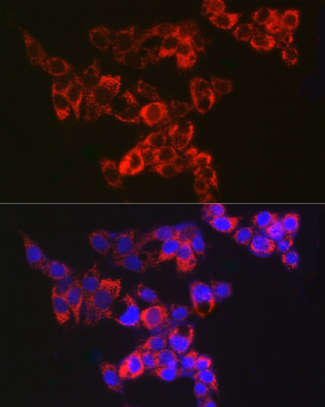 100UL ADENYLATE KINASE 4 ANTIBODY 100 UL