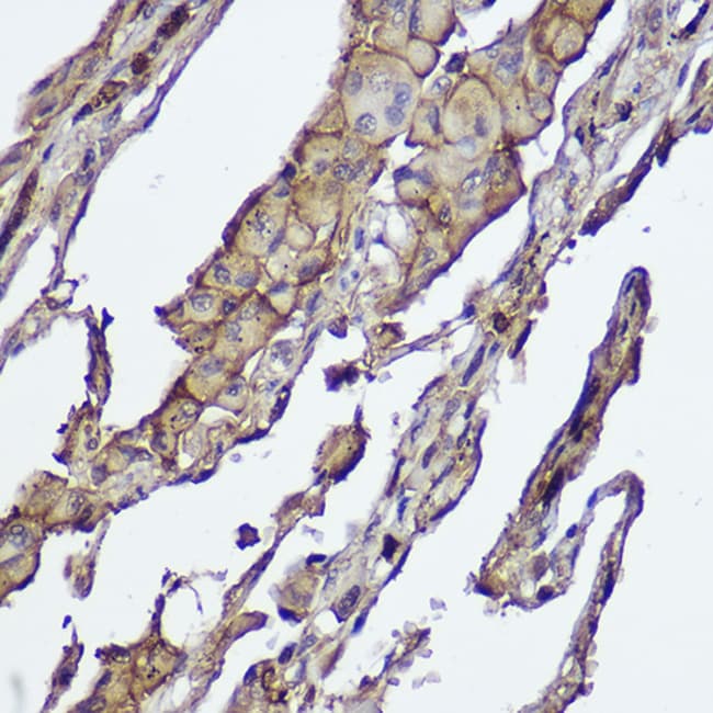 100UL AKT1/AKT2 ANTIBODY 100 UL