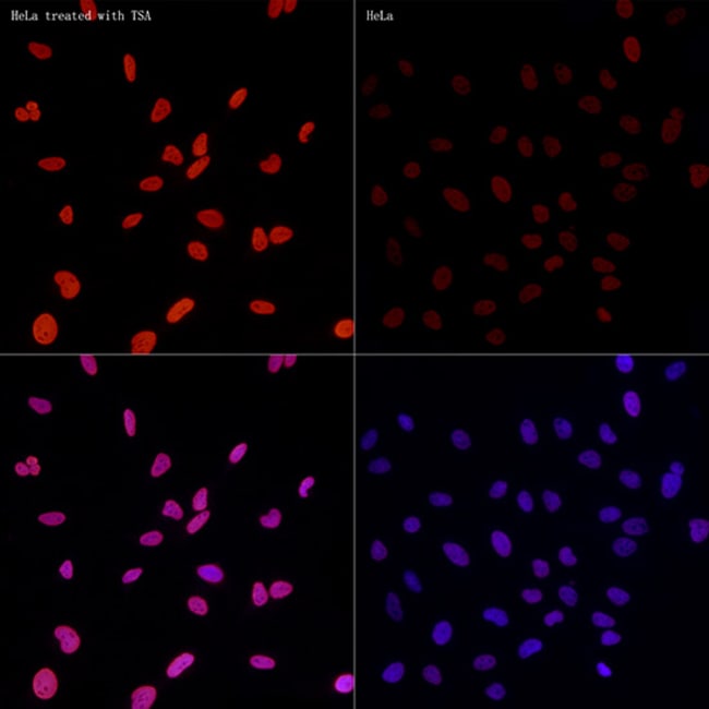 100UL ACETYL-HISTONE H3 ANTIBODY 100 UL