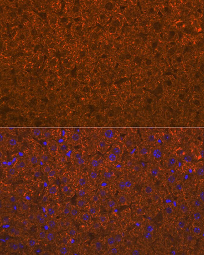 100UL ADAMTS13 ANTIBODY 100 UL