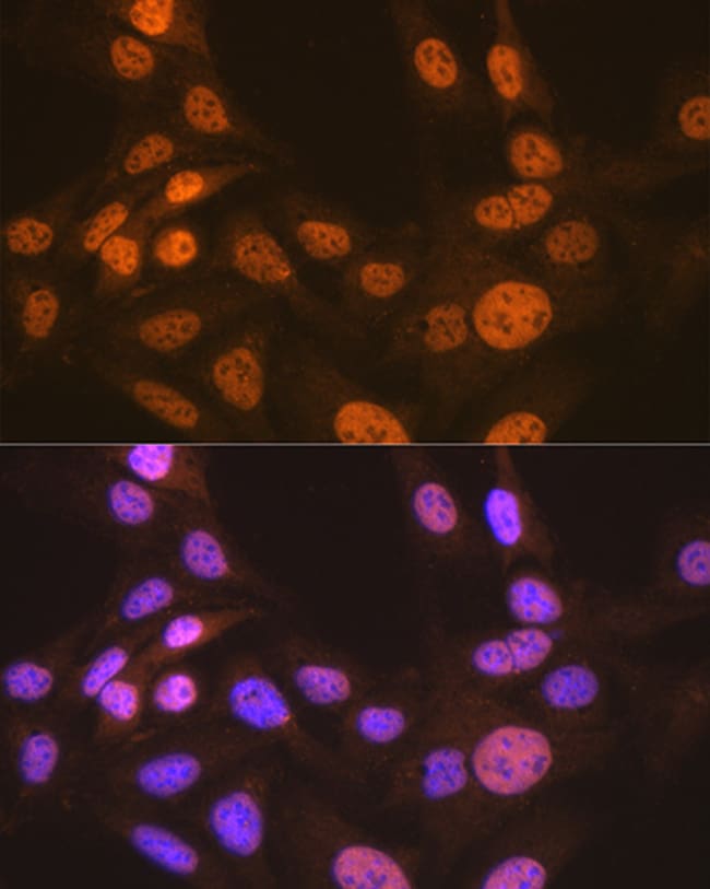 100UL APC6 ANTIBODY 100 UL