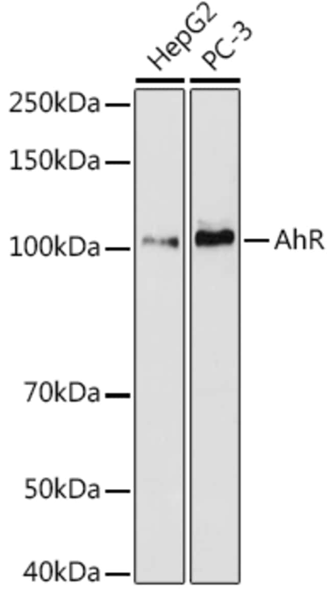 100UL AHR ANTIBODY 100 UL