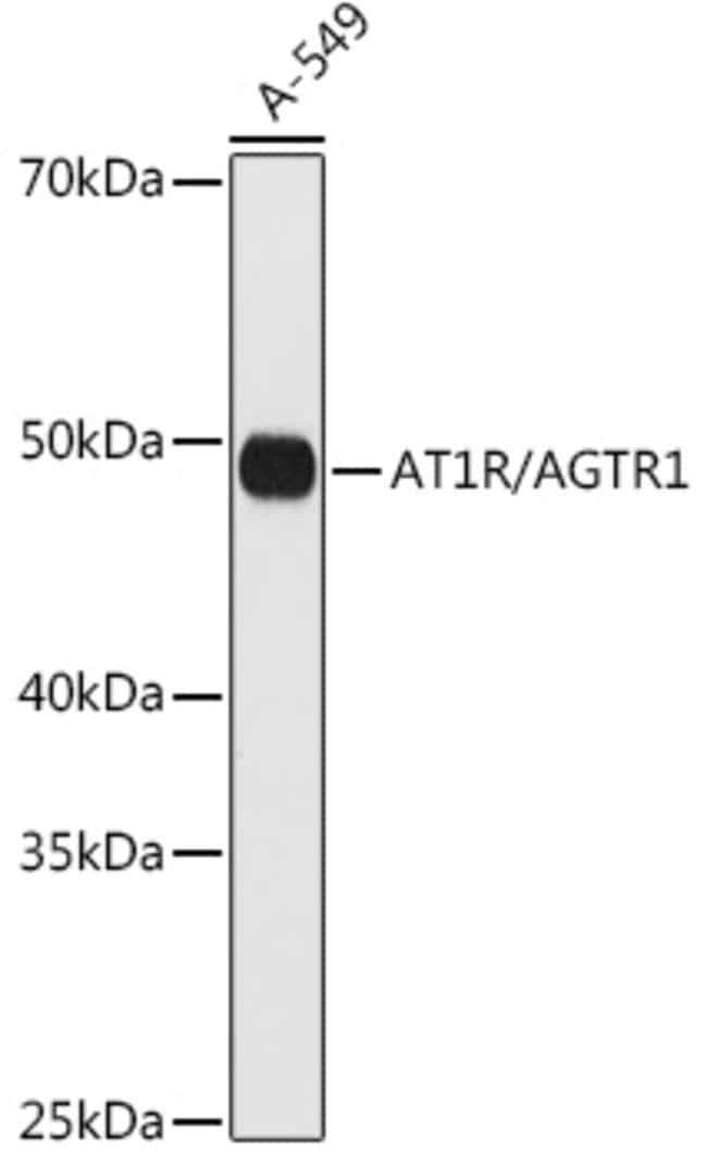 100UL AGTR1 ANTIBODY 100 UL