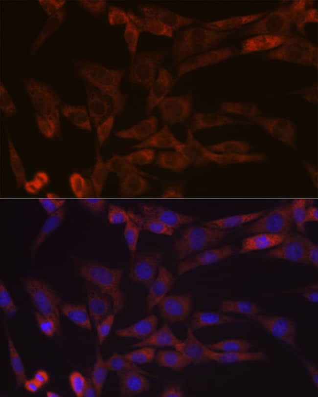 100UL ACTIVIN A ANTIBODY 100 UL