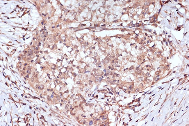100UL BAG2 ANTIBODY 100 UL