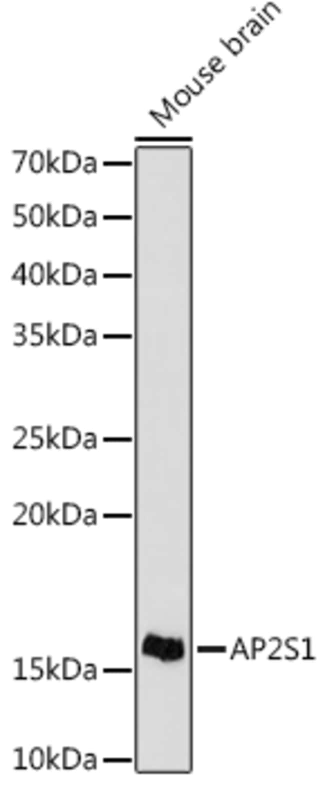 100UL AP2S1 ANTIBODY 100 UL
