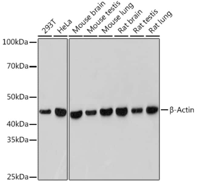 100UL BETA ACTIN ANTIBODY 100 UL