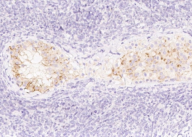 100UL AMH ANTIBODY 100 UL