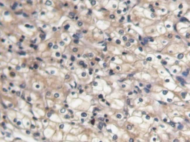 100UL BMP-7 ANTIBODY 100UL