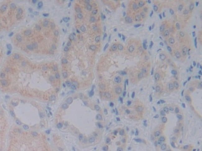 100UL BMP-10 ANTIBODY 100UL
