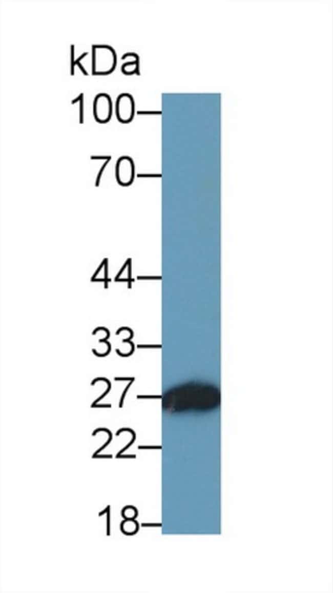 100UL AZUROCIDIN ANTIBODY 100UL