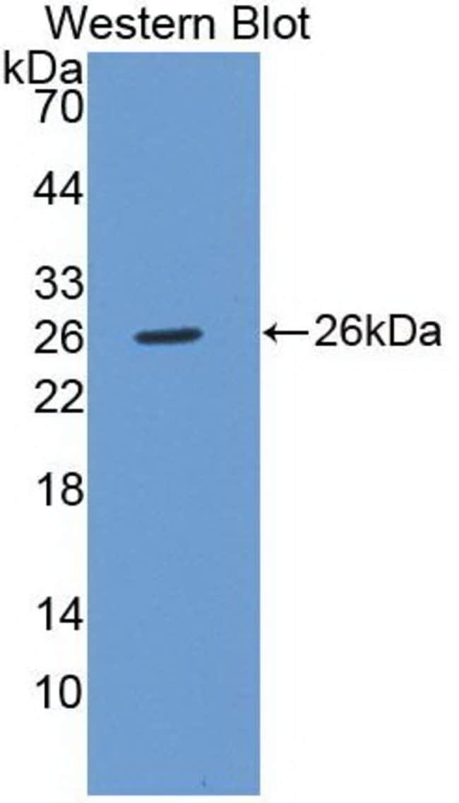 100UL ATROPHIN 1 ANTIBODY 100UL