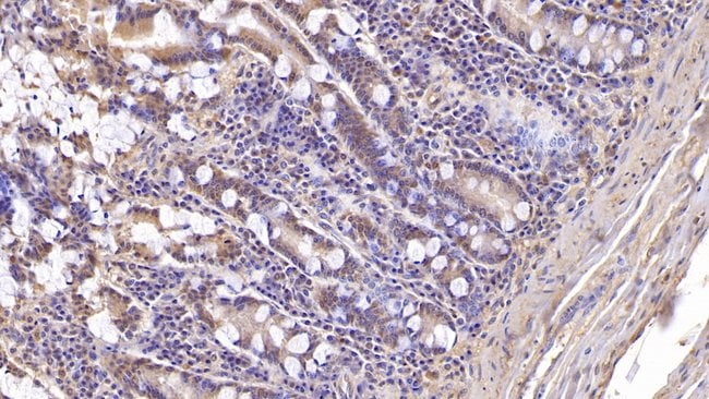 100UL ASPH ANTIBODY 100UL