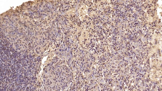 100UL ARMET ANTIBODY 100UL