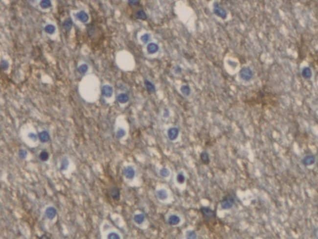 100UL AQUAPORIN 4 ANTIBODY 100UL