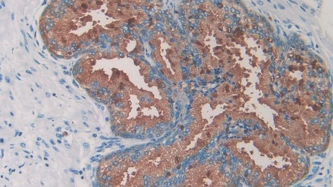 100UL AMYLIN ANTIBODY 100UL