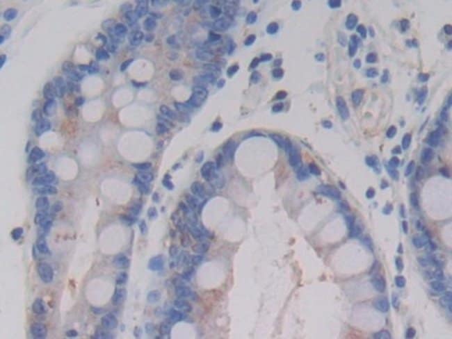 100UL AMH ANTIBODY 100UL