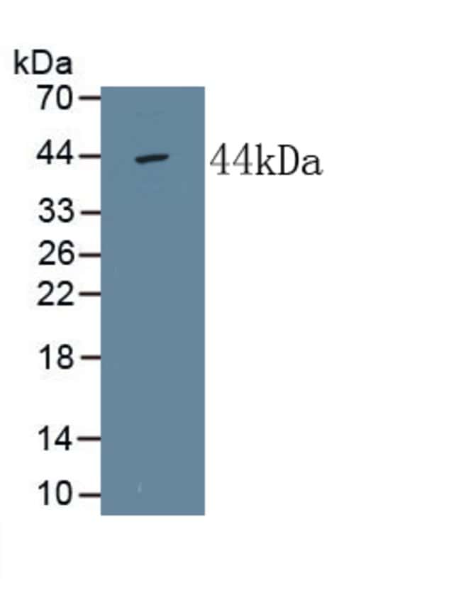100UL ALPL ANTIBODY 100UL
