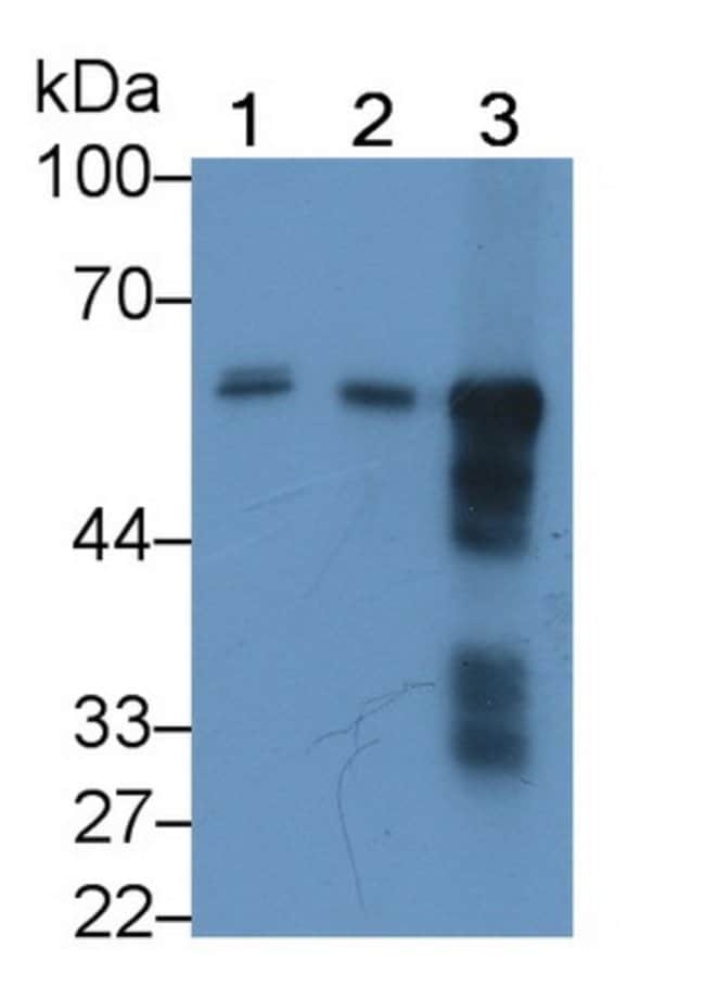 100UL ALPHA AMYLASE 1 ANTIBODY 100UL