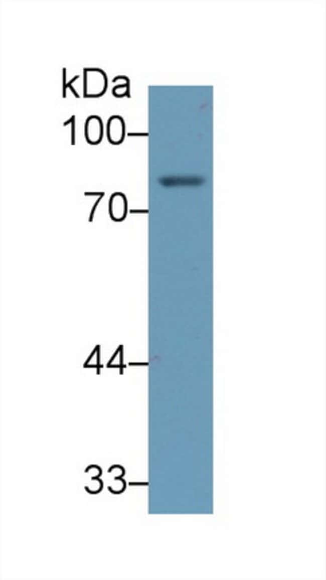 100UL ALOX5 ANTIBODY 100UL