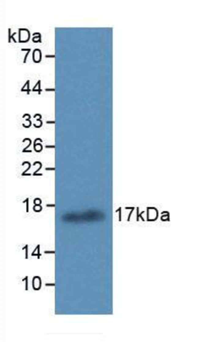 100UL ALOX15 ANTIBODY 100UL