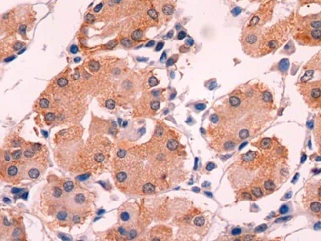 100UL ADRENOMEDULLIN ANTIBODY 100UL