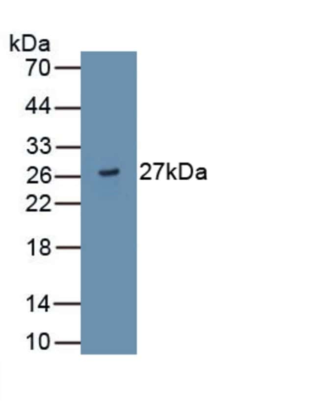 100UL ADAMTS9 ANTIBODY 100UL