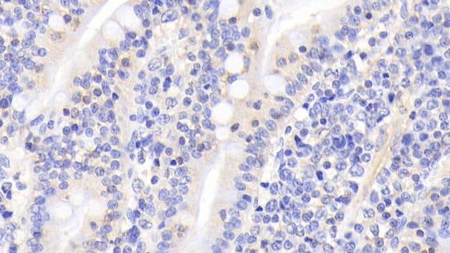 100UL ACTIVIN A ANTIBODY 100UL