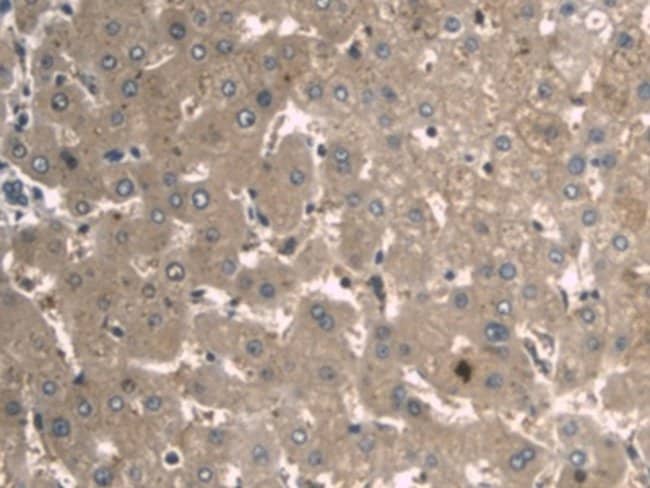 100UL A1BG ANTIBODY 100UL