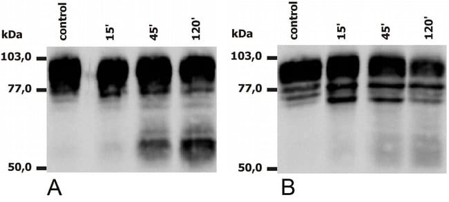 100UG CD18 ANTIBODY 100 UG