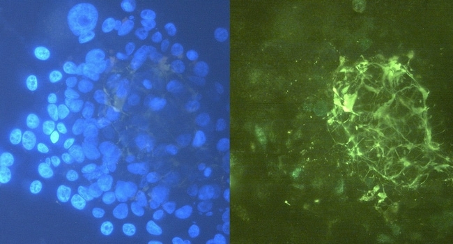 100UG TENASCIN C ANTIBODY 100 UG