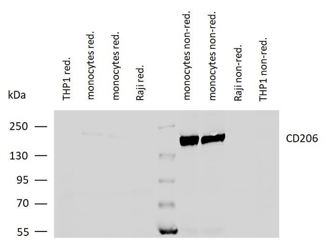 100UG CD206 ANTIBODY 100 UG