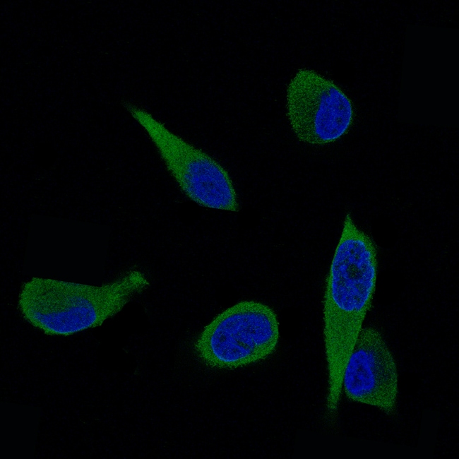 100UL ALDH1A3 ANTIBODY 100 UL