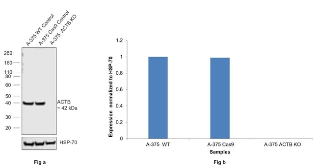 100UL BETA ACTIN ANTIBODY 100 UL