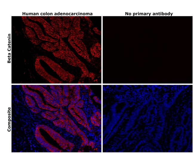 100UL BETA CATENIN ANTIBODY 100 UL