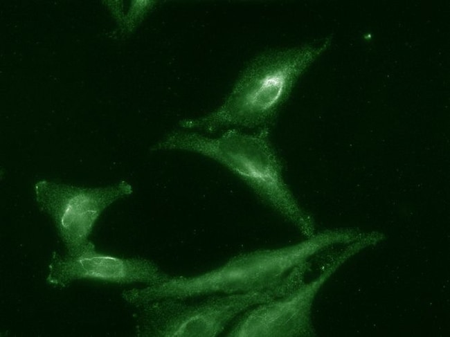 100UG AHA1 ANTIBODY FITC 100 UG