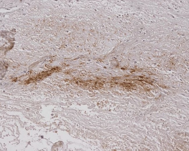 100UG ALGINATE ANTIBODY FITC 100 UG